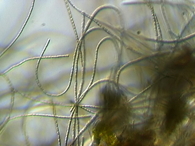 Anabaena sp