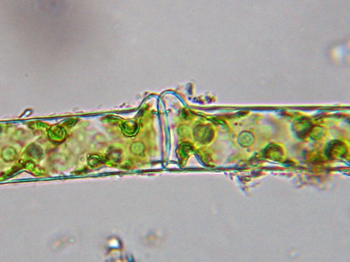 Spirogyra sp