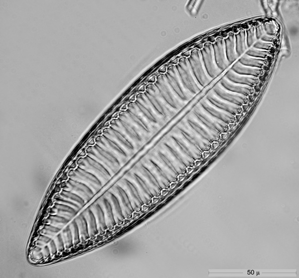 Surirella celtica