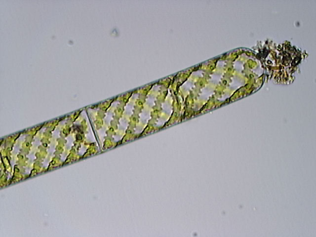 Spirogyra sp