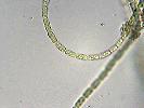 Anabaena sp