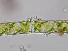 Spirogyra sp