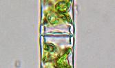 Spirogyra sp